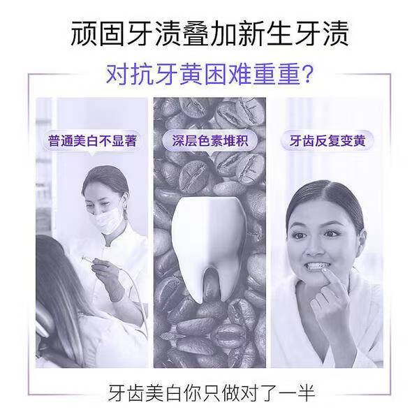 被追问无数次的牙齿美白秘籍！就是它插图3