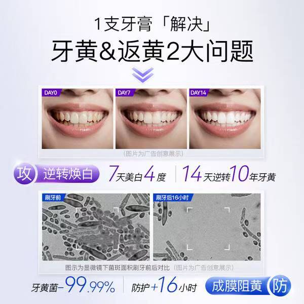 被追问无数次的牙齿美白秘籍！就是它插图2